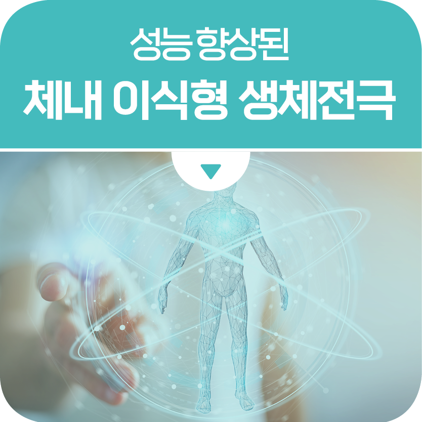 표면 특성 조절로 성능 향상된 체내 이식형 전극
