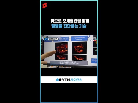 빛으로 모세혈관을 밝혀 질병을 진단하는 기술 #shorts