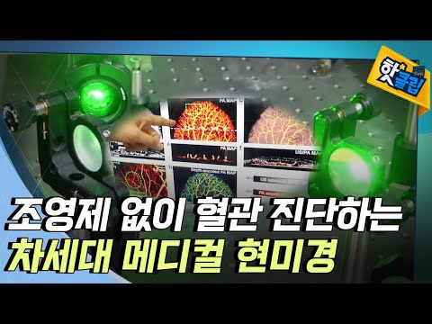 [핫클립] 약물 조영이 필요없는 현미경