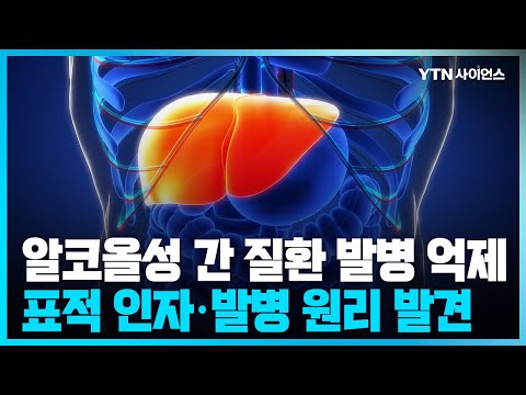 [과학뉴스] 국내연구진, 알코올성 간 질환 발병 억제하는 표적 인자 발견
