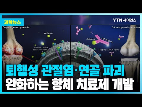 [과학뉴스] 국내연구진, 퇴행성 관절염 완화하는 새 항체 치료제 개발