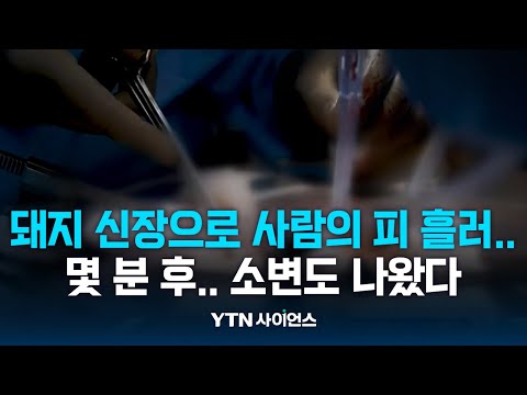 美, 뇌사자에 돼지신장 이식한 '이종이식' 사례.. 우리도 앞서간다 / 과학뉴스