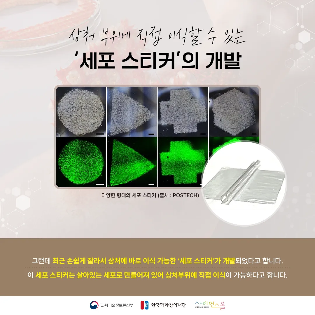 [숨사이언스] 반창고 대신 상처에 붙이면 치료가 된다? 세포 스티커