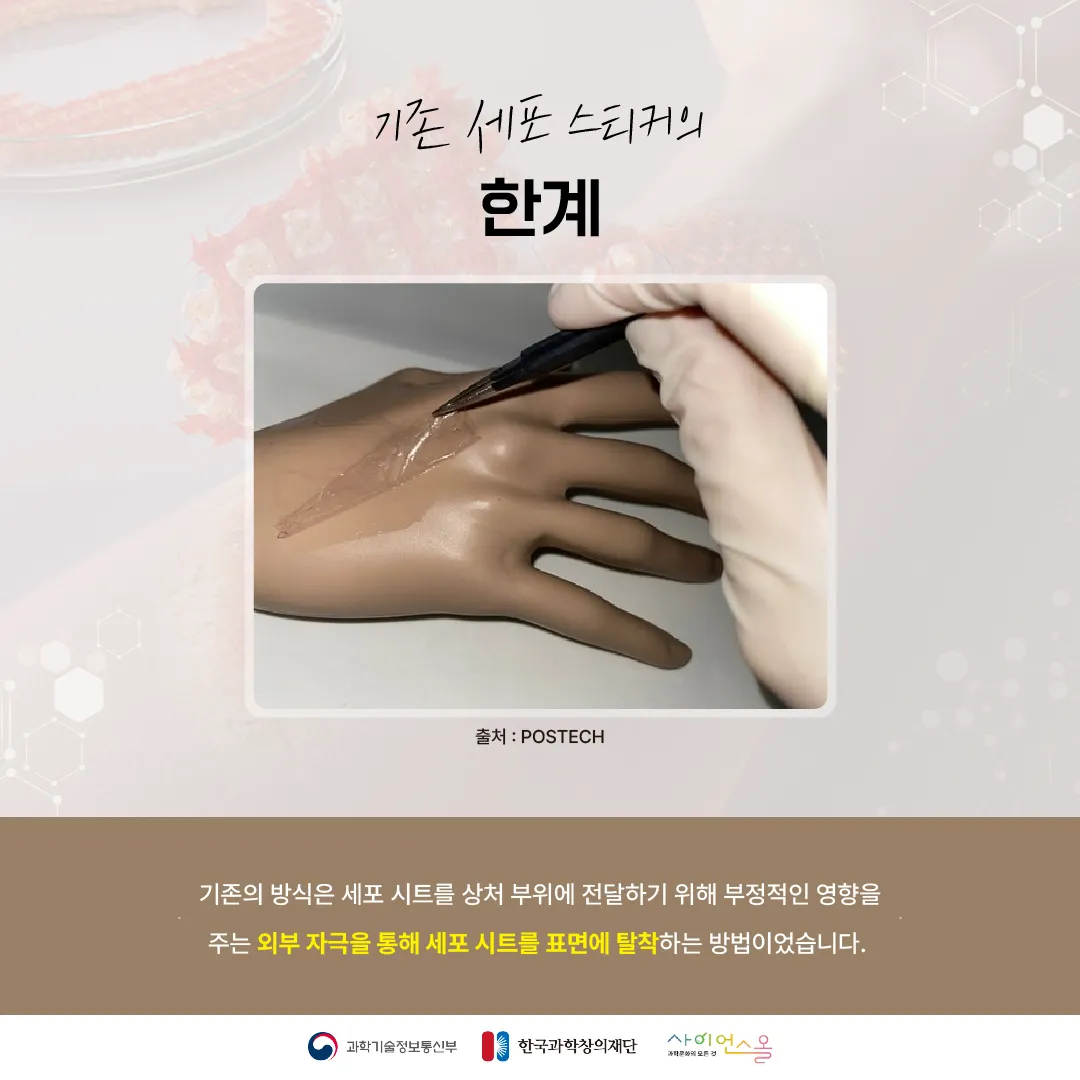 [숨사이언스] 반창고 대신 상처에 붙이면 치료가 된다? 세포 스티커