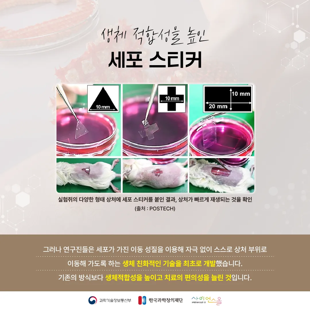 [숨사이언스] 반창고 대신 상처에 붙이면 치료가 된다? 세포 스티커