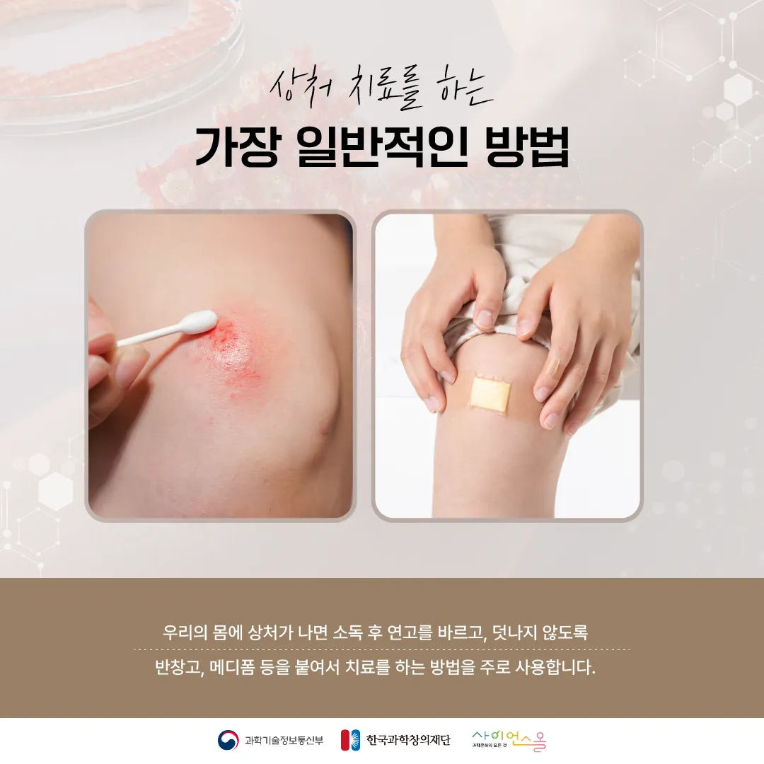 [숨사이언스] 반창고 대신 상처에 붙이면 치료가 된다? 세포 스티커