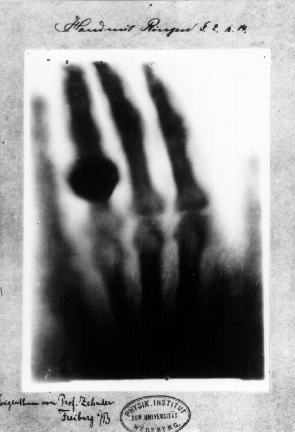 First_medical_X-ray_by