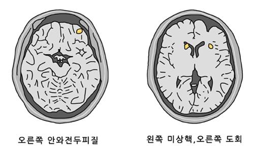 우좌뇌