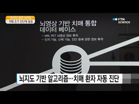 [사이언스TV] 치매 예측 ‘한국인 표준 뇌지도’ 완성