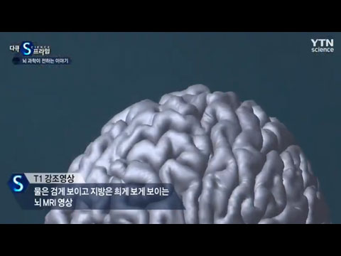 [사이언스TV] 뇌 과학이 전하는 이야기