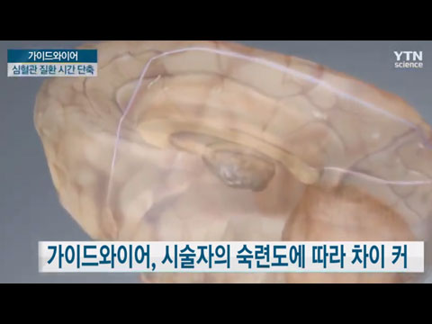 [사이언스TV] 복잡한 혈관도 척척 ‘가이드와이어 마이크로 로봇’