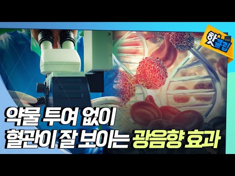 [핫클립] 광음향 효과란 무엇인가?