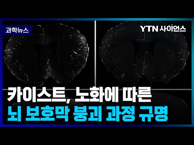 [과학뉴스] 축적된 당이 뇌 보호막 주성분 ‘콜라겐’ 붕괴