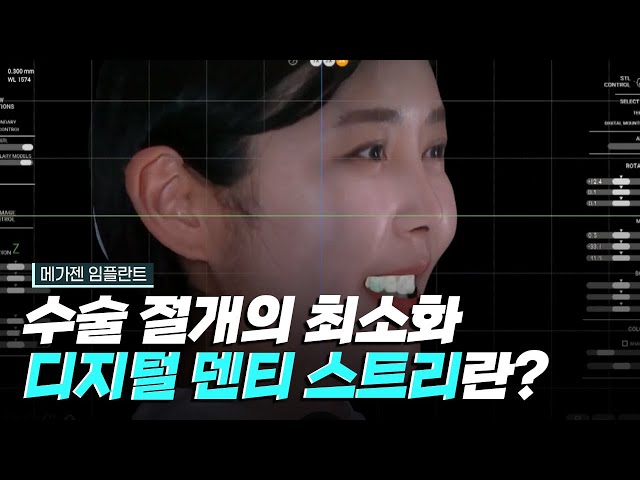 [핫클립] 치과 수술의 내비게이션, 디지털 덴티스트리