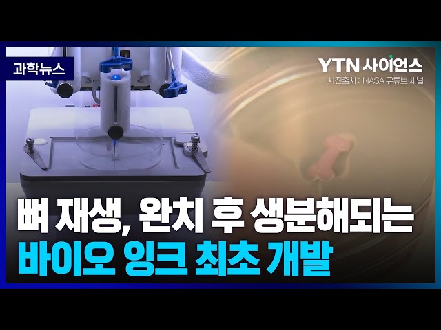 [과학뉴스] 국내 연구진, 부러진 뼈에 바르면 재생.. 완치 후 사라지는 바이오 잉크 개발.. 상용화 가능성 앞당겨