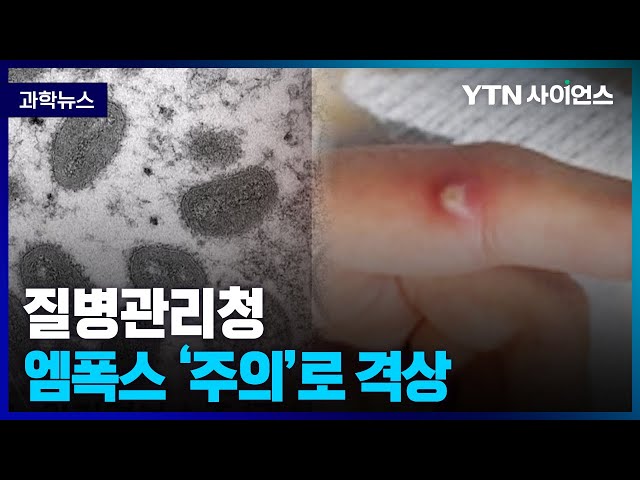 [과학뉴스] 엠폭스(원숭이두창) 9번째 확진자 발생 .. 위기경보수준 ‘주의’로 격상