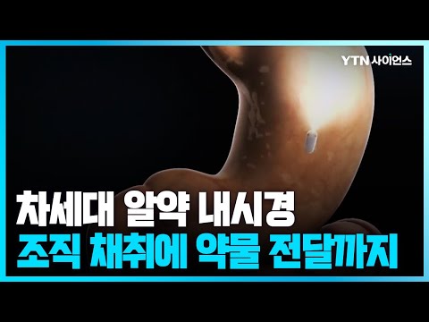 [과학뉴스] 주요 진단 부위 95% 촬영 성공, 기존 내시경 진단과도 동일