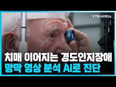 [과학뉴스] 망막 영상으로 경도 인지 장애 진단하는 AI 개발