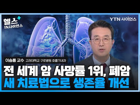 담배 끊으면 폐암 사망률 절반으로 감소..폐암 생존율 높이는 ‘면역 항암제’ 병용요법, 항암치료보다 부작용도 적다