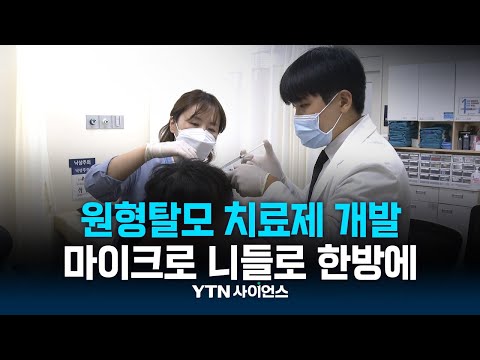 콕콕콕 원형탈모 주사, 마이크로 니들로 한방에 두피 속에 넣는다