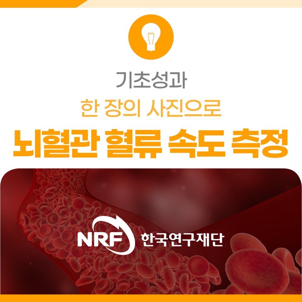 한 장의 사진으로 뇌혈관 혈류 속도 측정한다